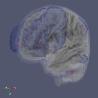 Brain_Activation_Visualization.png