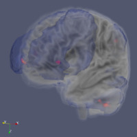 Brain scan on a dark grey/ blue square background.